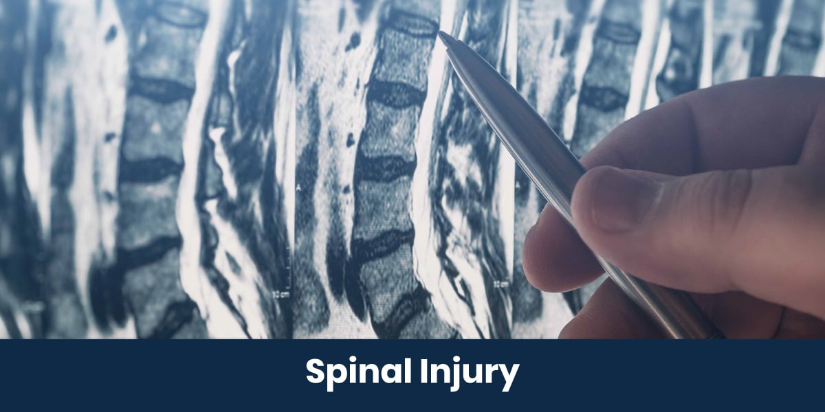 Los Angeles Spinal Cord Injury Attorney Moaddel Kremer & Gerome LLP
